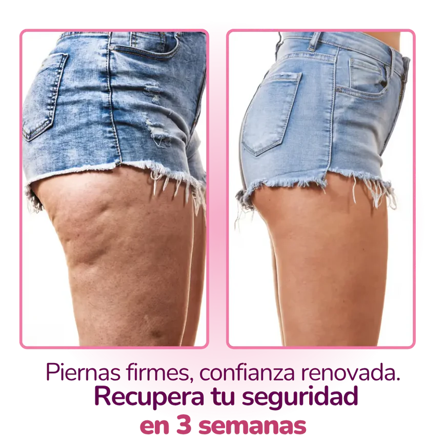 VIL CelulYtBiotic Colombia: Adiós Celulitis y Retención | Piel Firme desde Adentro