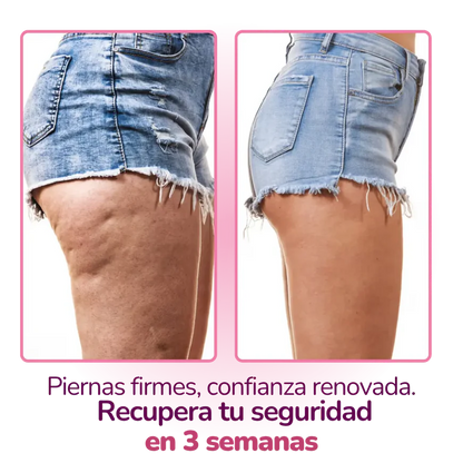 VIL CelulYtBiotic Colombia: Adiós Celulitis y Retención | Piel Firme desde Adentro